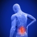 Lower Back Pain Clinic